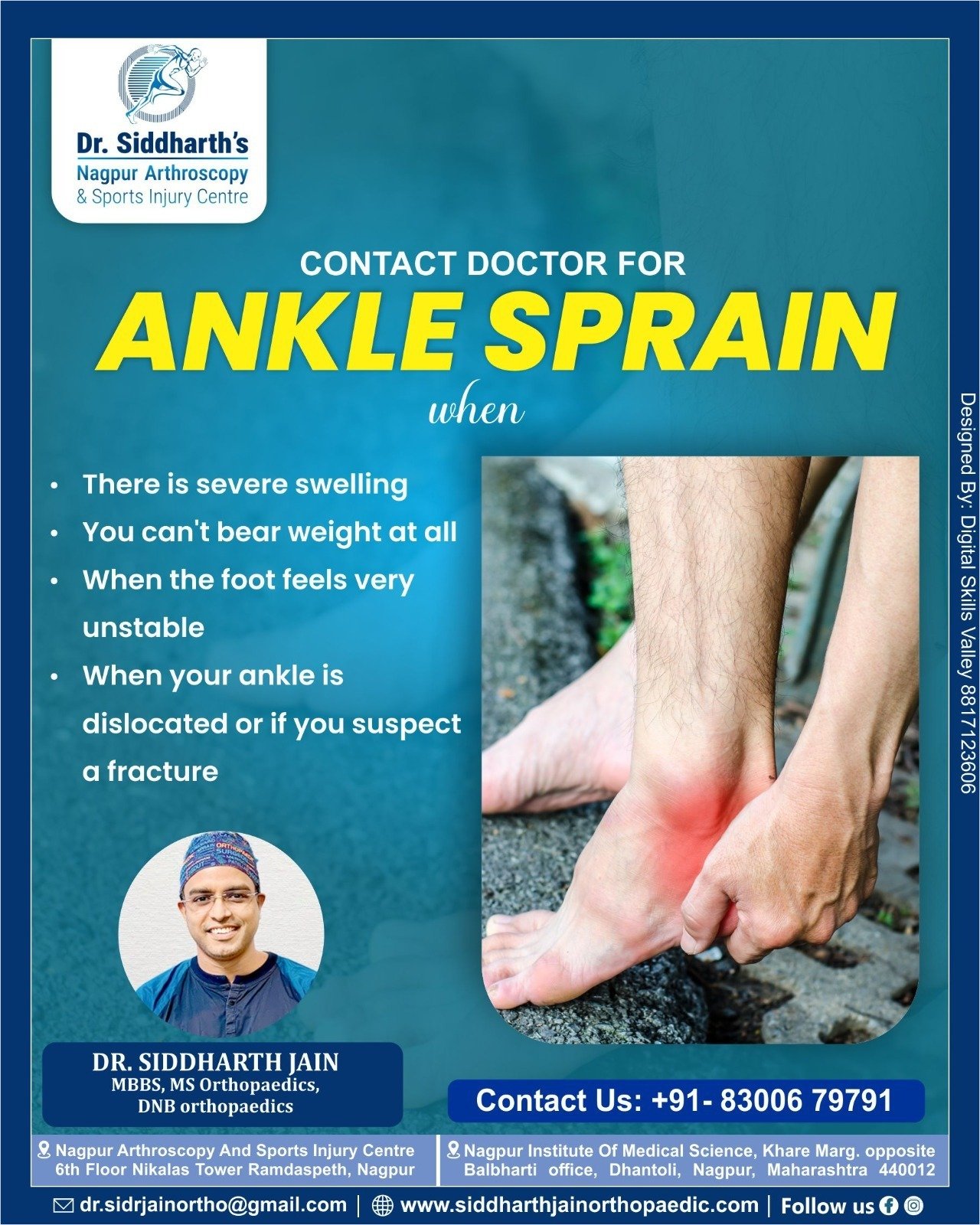 Ankle Sprains