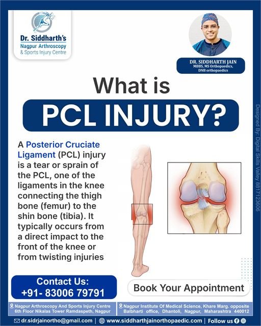 PCL Injuries: Causes, Symptoms, and Treatment Options | Dr. Siddharth Jain